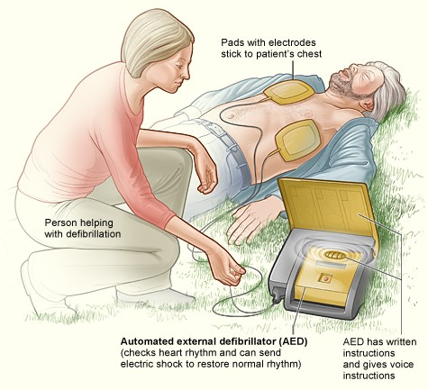 Automated cardiac Defibrillator