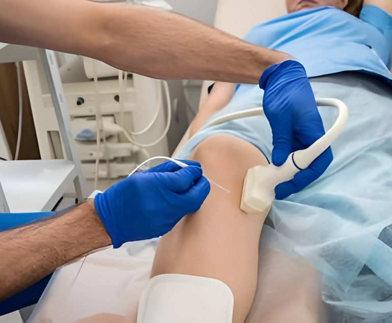 Vein ablation