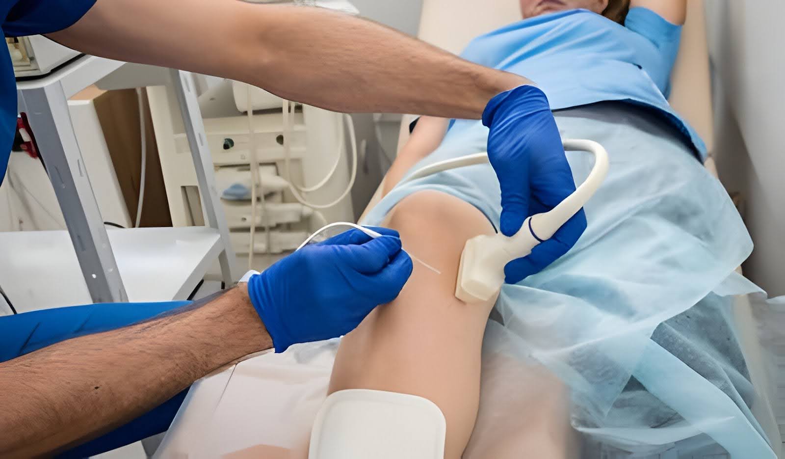 Vein ablation